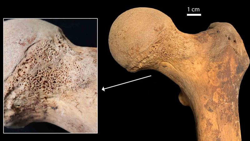 bone sample cannabis